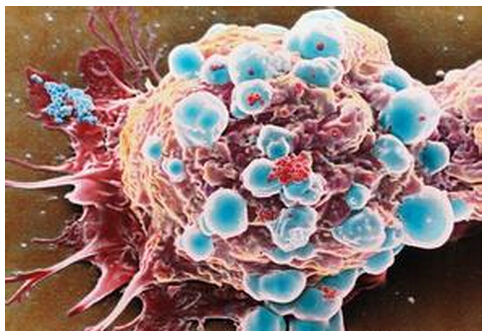 中国开发给药系统既杀乳腺癌细胞又杀癌症干细胞
